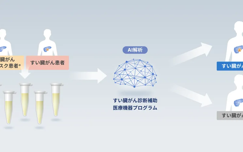 すい臓がん診断補助プログラムの模式図(同社リリースより)